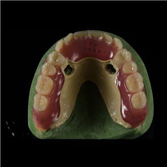 Peek Framework gervitennur