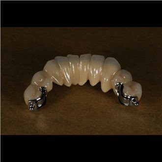 Precision Attachment Part Dentures