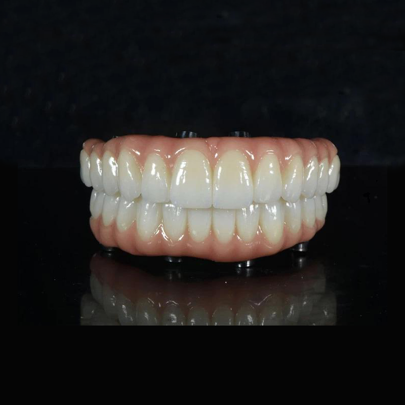ALL-ON -X ZIRCONIA BRÚ